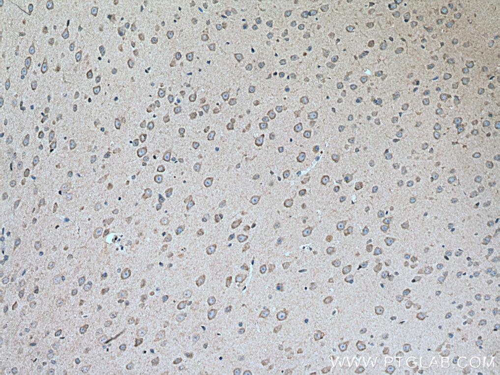 IHC staining of mouse brain using 16055-1-AP