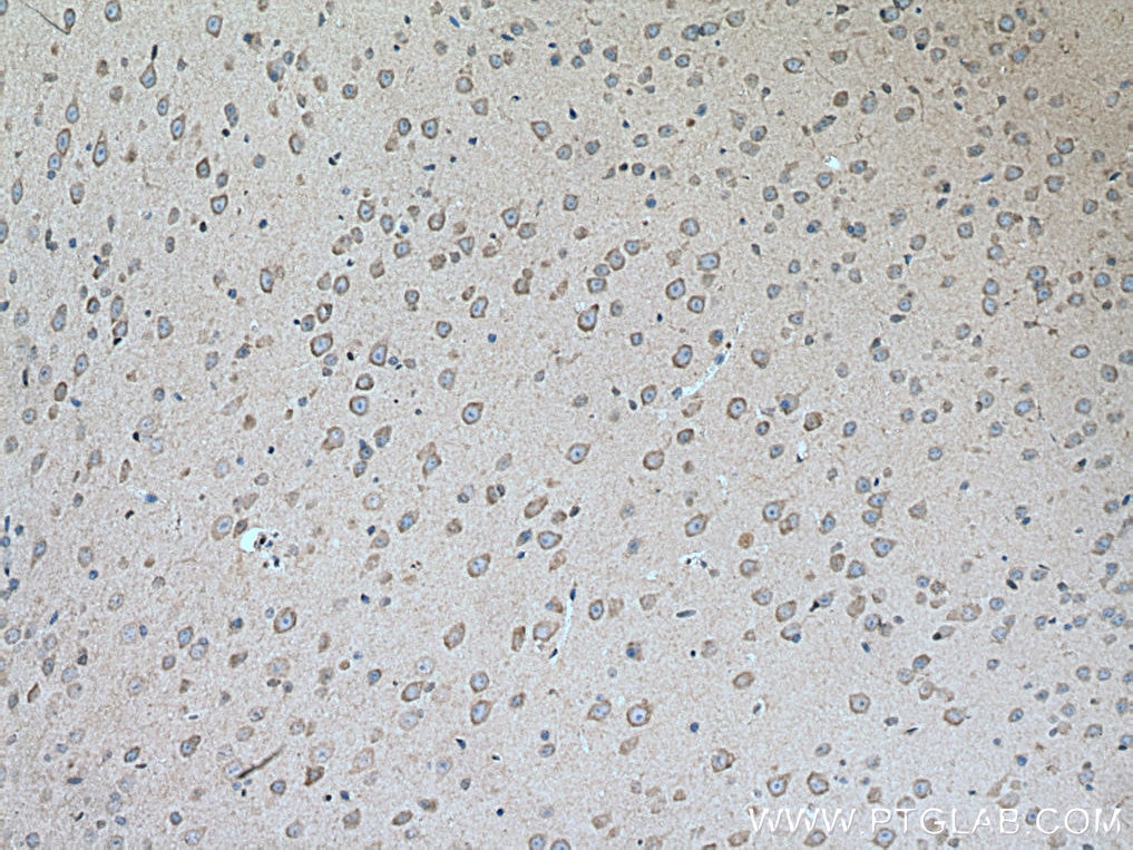 Immunohistochemistry (IHC) staining of mouse brain tissue using LYPLA1 Polyclonal antibody (16055-1-AP)