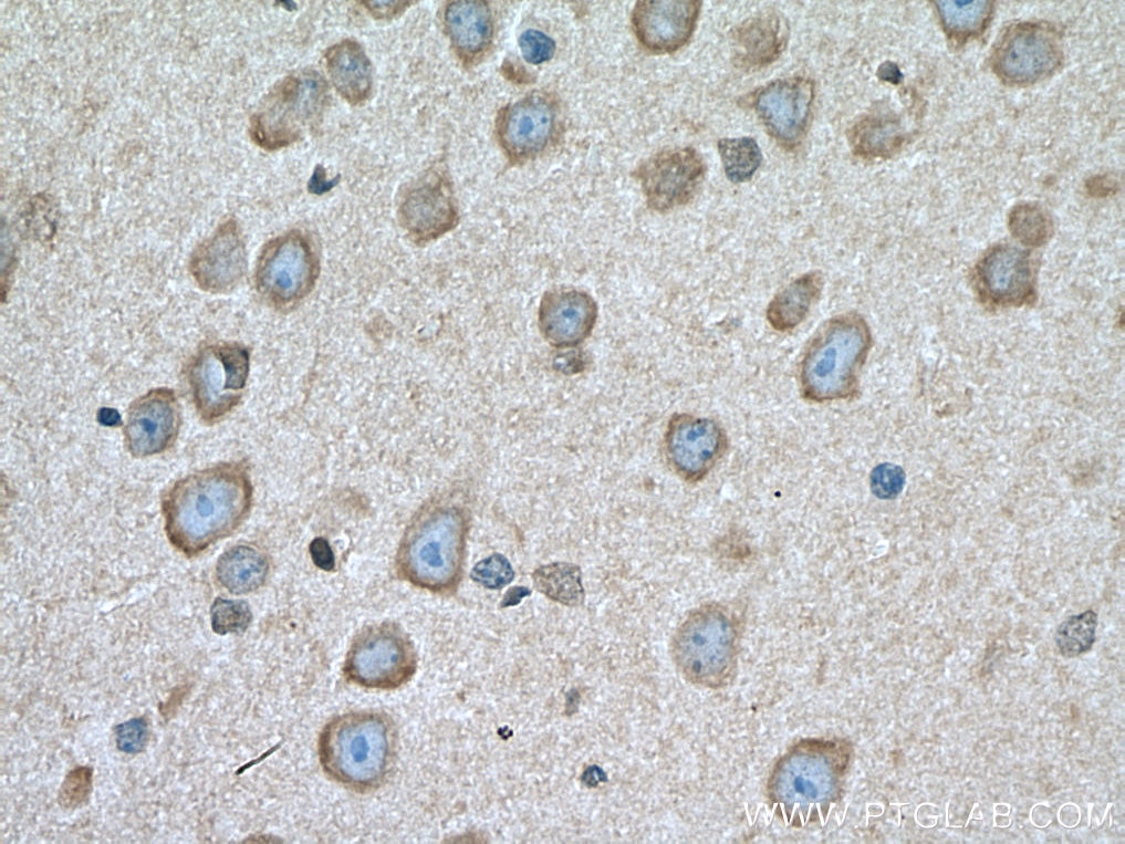 Immunohistochemistry (IHC) staining of mouse brain tissue using LYPLA1 Polyclonal antibody (16055-1-AP)