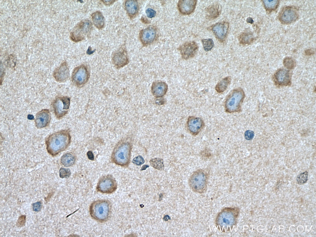 IHC staining of mouse brain using 16055-1-AP