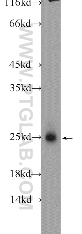 Western Blot (WB) analysis of rat liver tissue using LYPLA1 Polyclonal antibody (16055-1-AP)