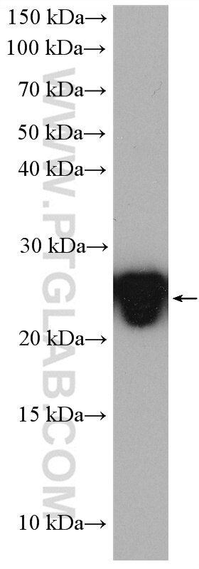 WB analysis of mouse brain using 16055-1-AP