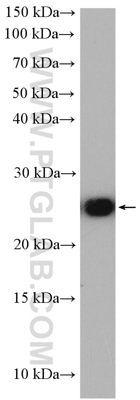 Western Blot (WB) analysis of HeLa cells using LYPLA1 Polyclonal antibody (16055-1-AP)