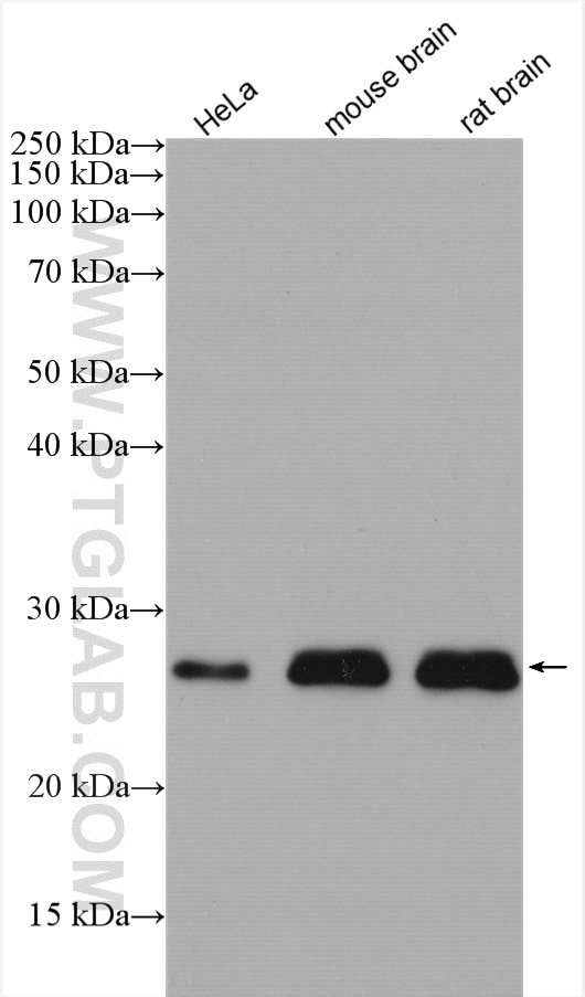 Western Blot (WB) analysis of various lysates using LYPLA1 Polyclonal antibody (16055-1-AP)