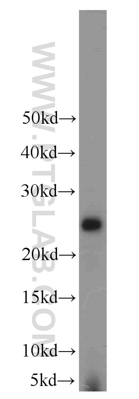 Western Blot (WB) analysis of rat brain tissue using LYPLA1 Polyclonal antibody (16055-1-AP)
