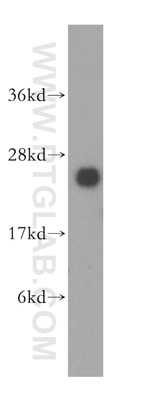 Western Blot (WB) analysis of human brain tissue using LYPLA1 Polyclonal antibody (16055-1-AP)