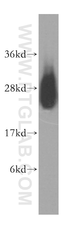 Western Blot (WB) analysis of human liver tissue using LYPLA1 Polyclonal antibody (16055-1-AP)