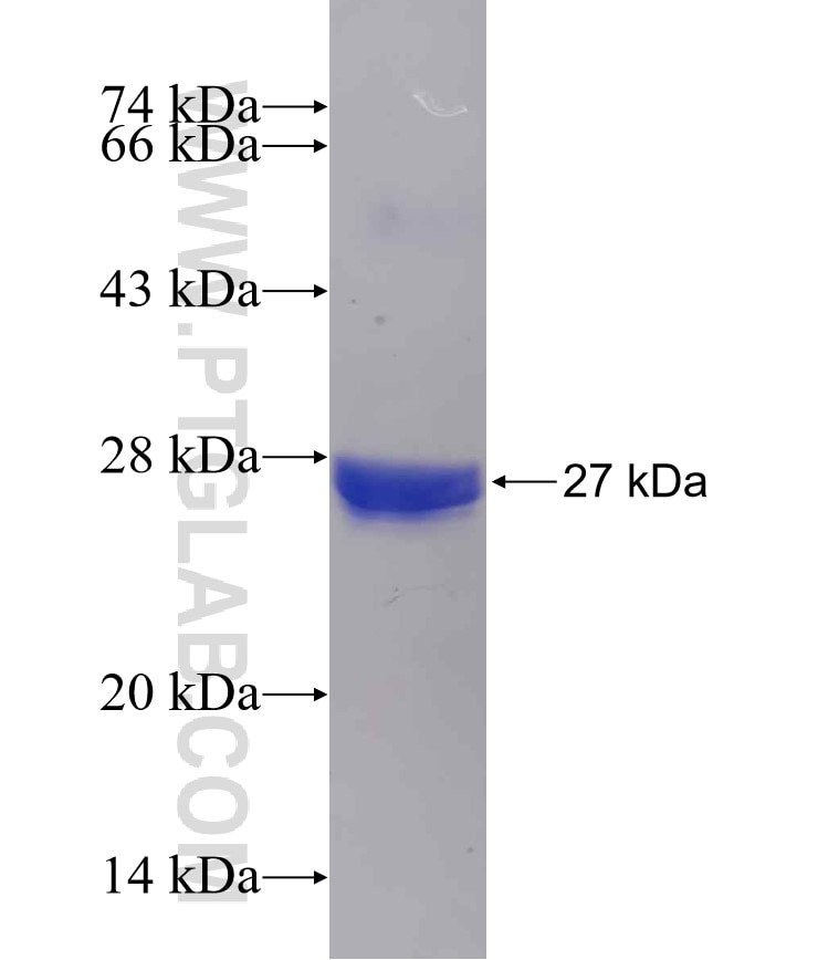 LYPLA1 fusion protein Ag8986 SDS-PAGE