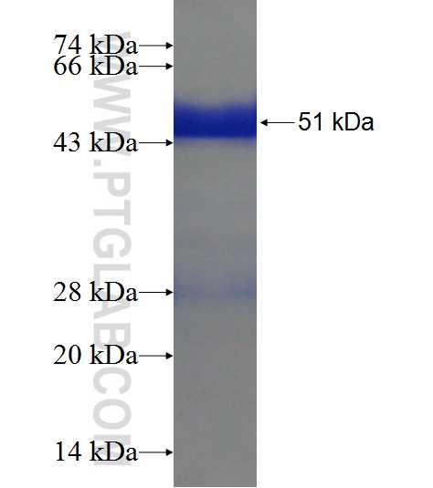 LYPLA1 fusion protein Ag9022 SDS-PAGE