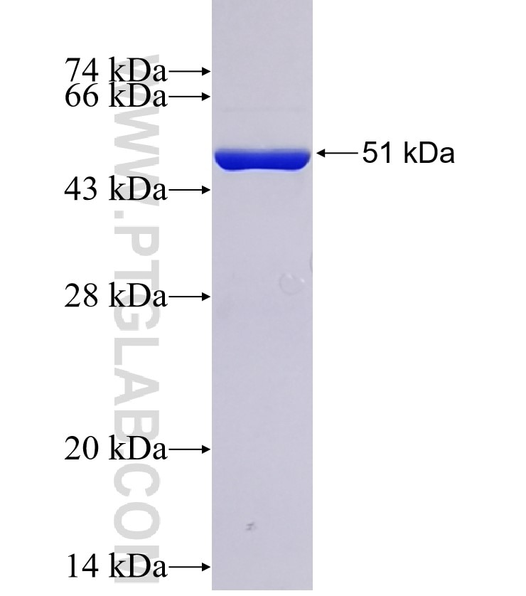 LYPLA2 fusion protein Ag9452 SDS-PAGE