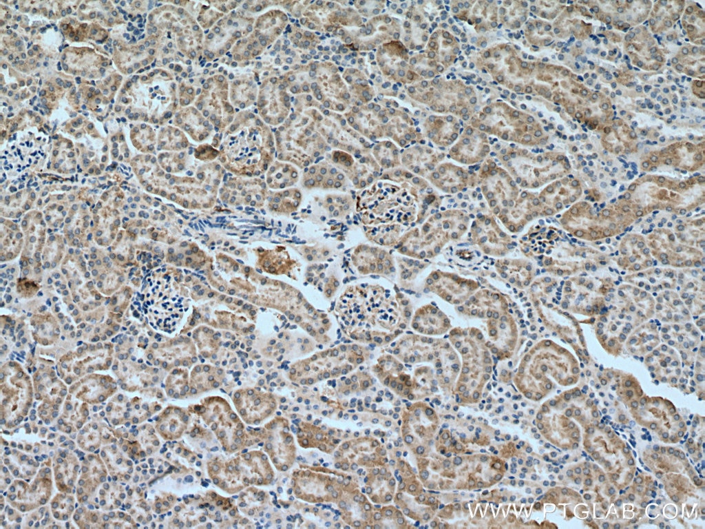 Immunohistochemistry (IHC) staining of mouse kidney tissue using LYPLAL1 Polyclonal antibody (16146-1-AP)
