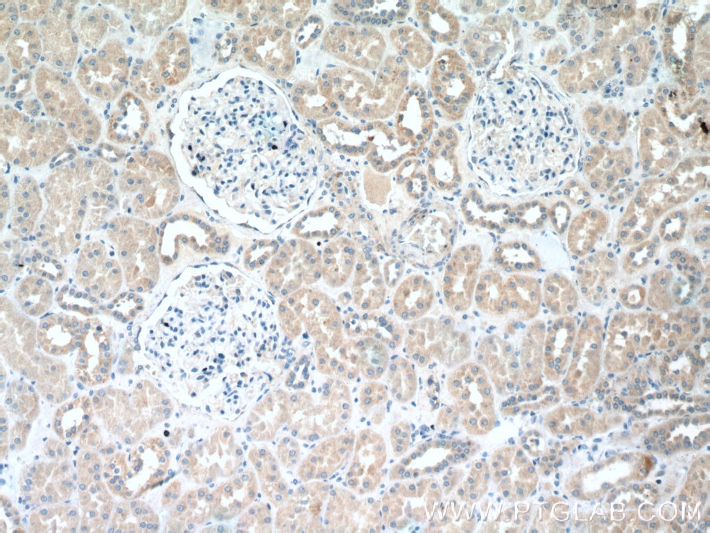 Immunohistochemistry (IHC) staining of human kidney tissue using LYPLAL1 Polyclonal antibody (16146-1-AP)
