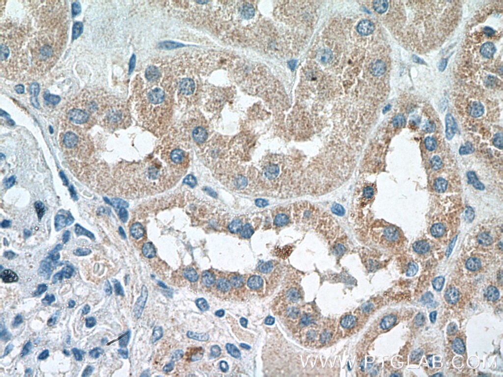 Immunohistochemistry (IHC) staining of human kidney tissue using LYPLAL1 Polyclonal antibody (16146-1-AP)