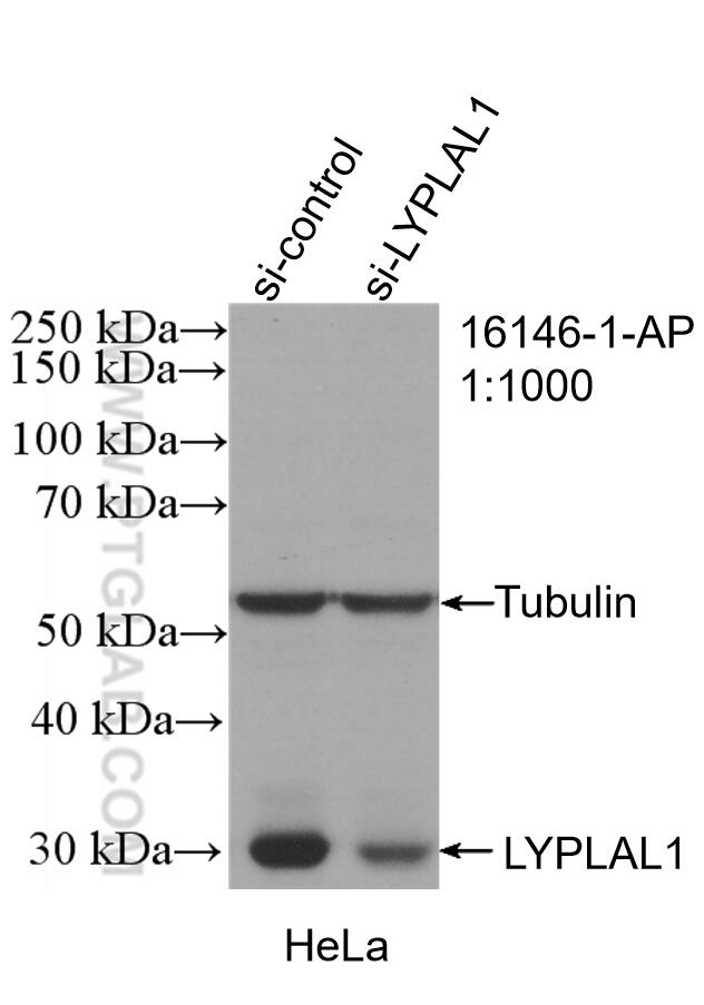 Western Blot (WB) analysis of HeLa cells using LYPLAL1 Polyclonal antibody (16146-1-AP)