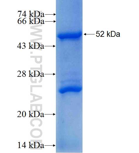 LYPLAL1 fusion protein Ag9271 SDS-PAGE