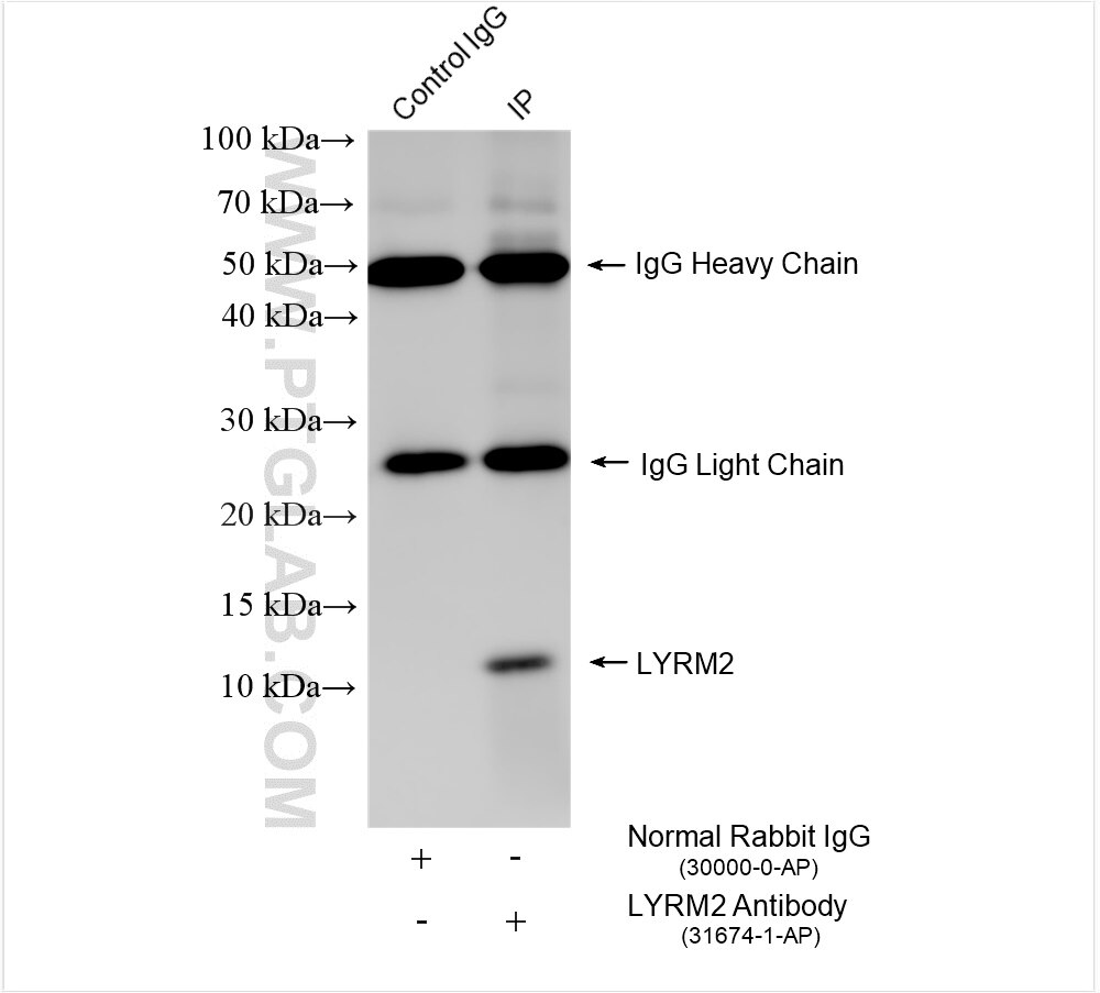 IP experiment of COLO 320 using 31674-1-AP Immunoprecipitation (IP) experiment of COLO 320 cells using LYRM2 Polyclonal antibody (31674-1-AP)