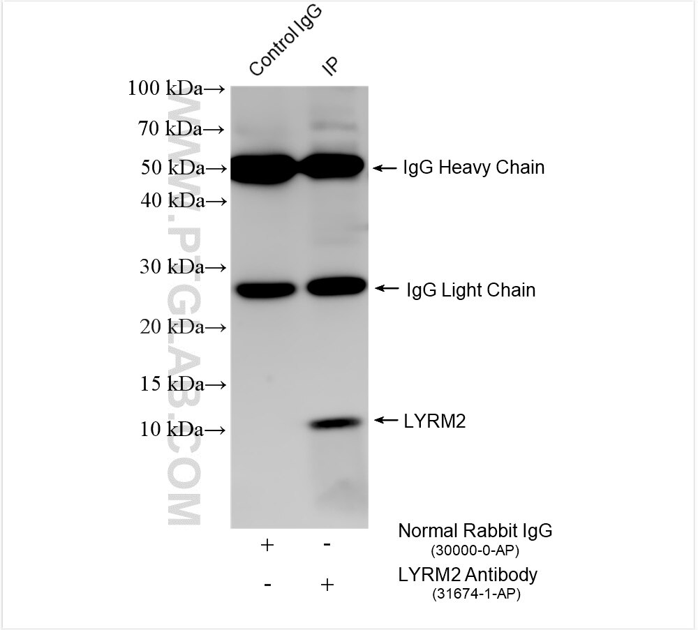 IP experiment of HT-29 using 31674-1-AP Immunoprecipitation (IP) experiment of HT-29 cells using LYRM2 Polyclonal antibody (31674-1-AP)