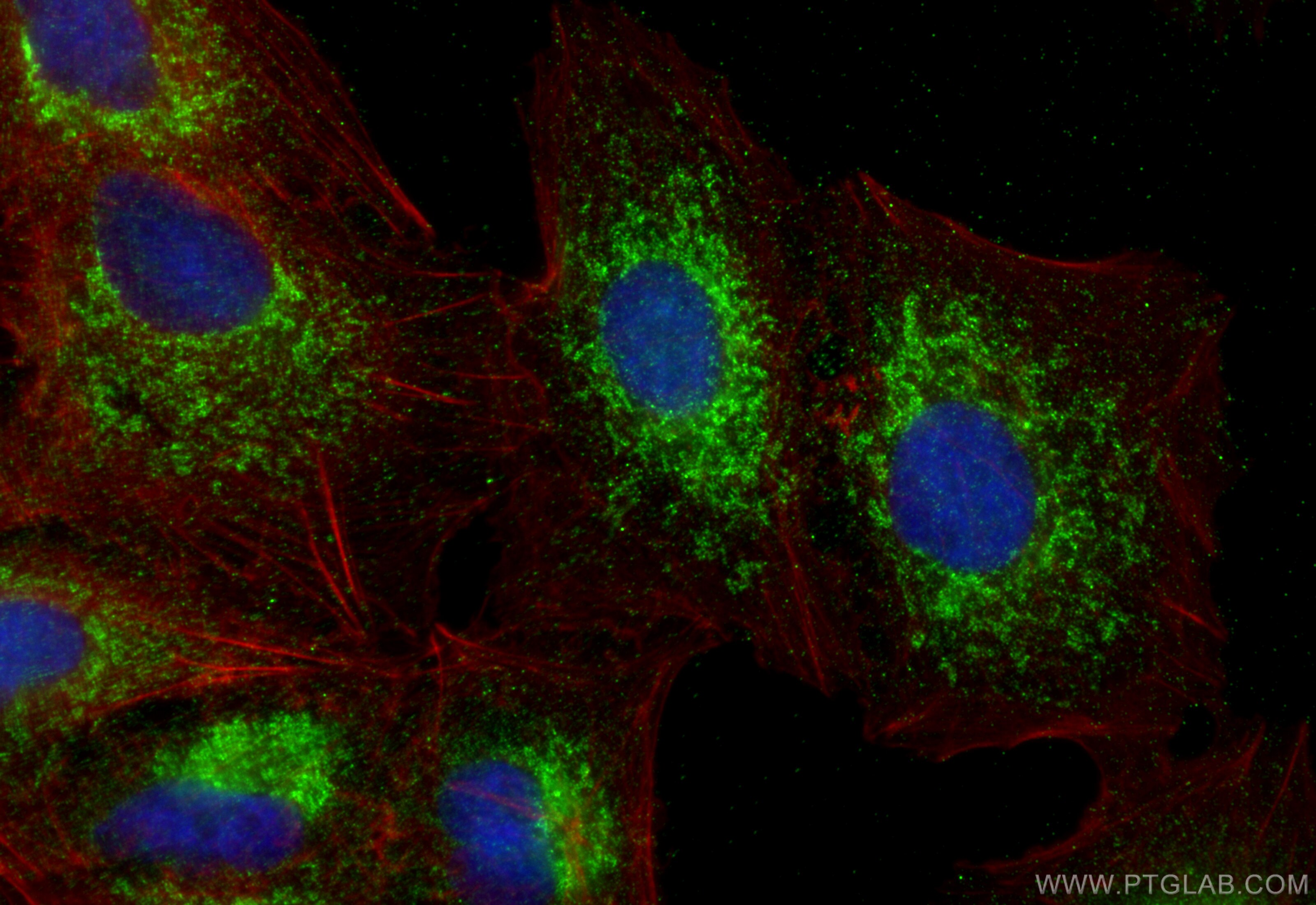 Immunofluorescence (IF) / fluorescent staining of A549 cells using LYRM5 Polyclonal antibody (31548-1-AP)