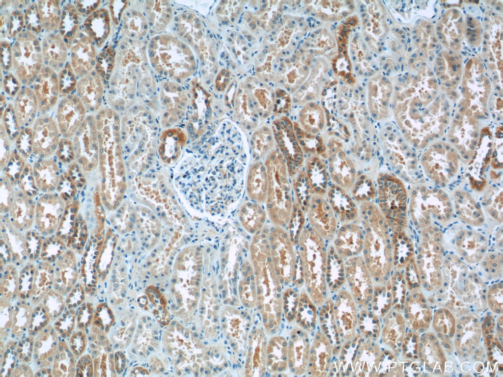 Immunohistochemistry (IHC) staining of human kidney tissue using LYRM7 Polyclonal antibody (23833-1-AP)