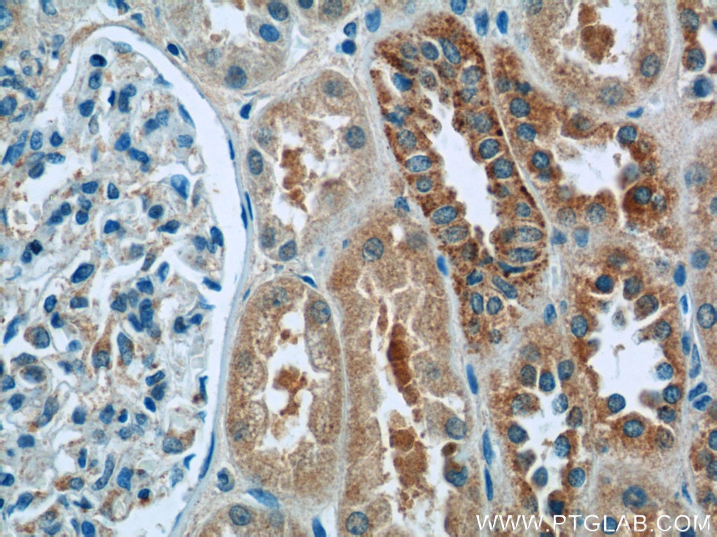 Immunohistochemistry (IHC) staining of human kidney tissue using LYRM7 Polyclonal antibody (23833-1-AP)