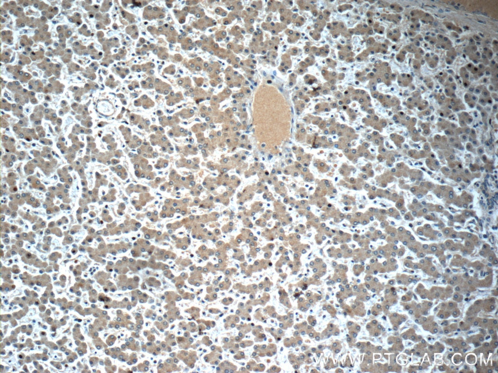 Immunohistochemistry (IHC) staining of human liver tissue using LYRM7 Polyclonal antibody (23833-1-AP)