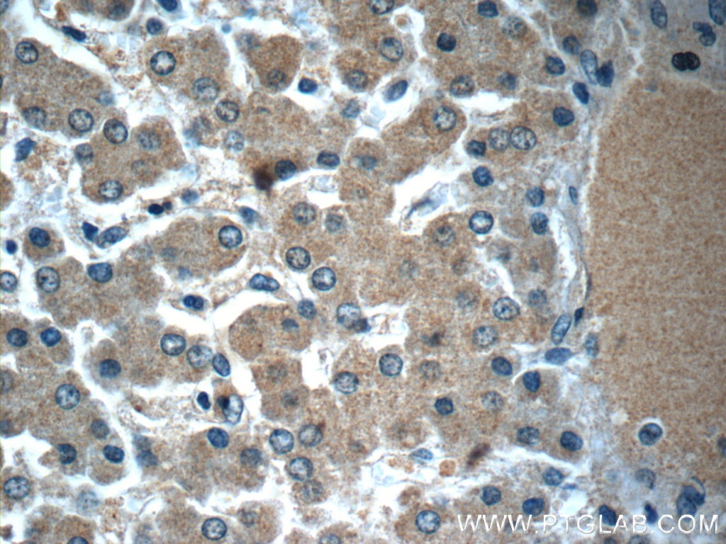 Immunohistochemistry (IHC) staining of human liver tissue using LYRM7 Polyclonal antibody (23833-1-AP)