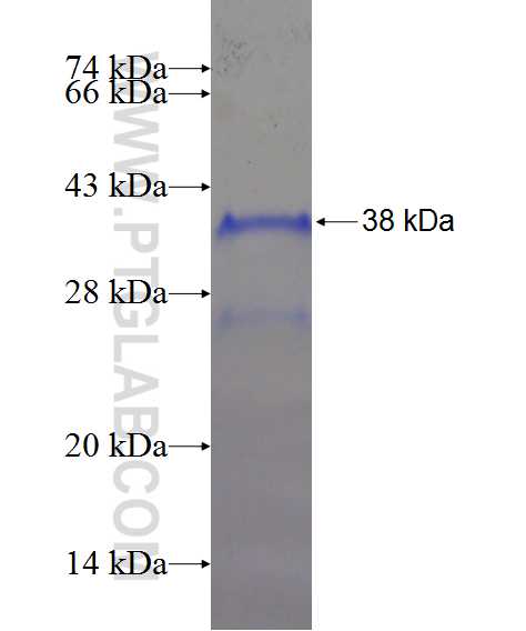 LYRM7 fusion protein Ag20696 SDS-PAGE