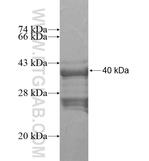 LYSMD2 fusion protein Ag11169 SDS-PAGE