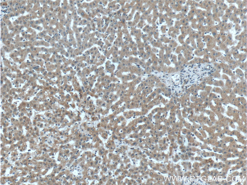 Immunohistochemistry (IHC) staining of human liver tissue using LYSMD3 Polyclonal antibody (24313-1-AP)
