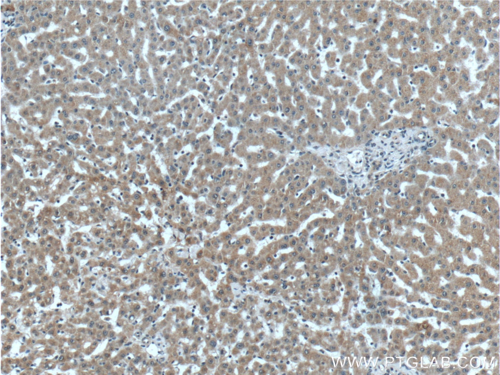 Immunohistochemistry (IHC) staining of human liver tissue using LYSMD3 Polyclonal antibody (24313-1-AP)