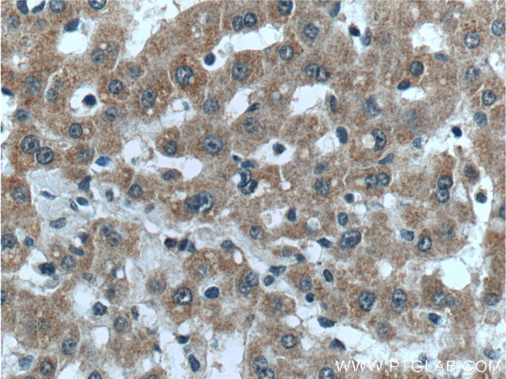 Immunohistochemistry (IHC) staining of human liver tissue using LYSMD3 Polyclonal antibody (24313-1-AP)