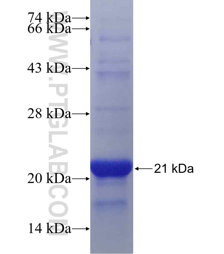 LYSMD3 fusion protein Ag19496 SDS-PAGE