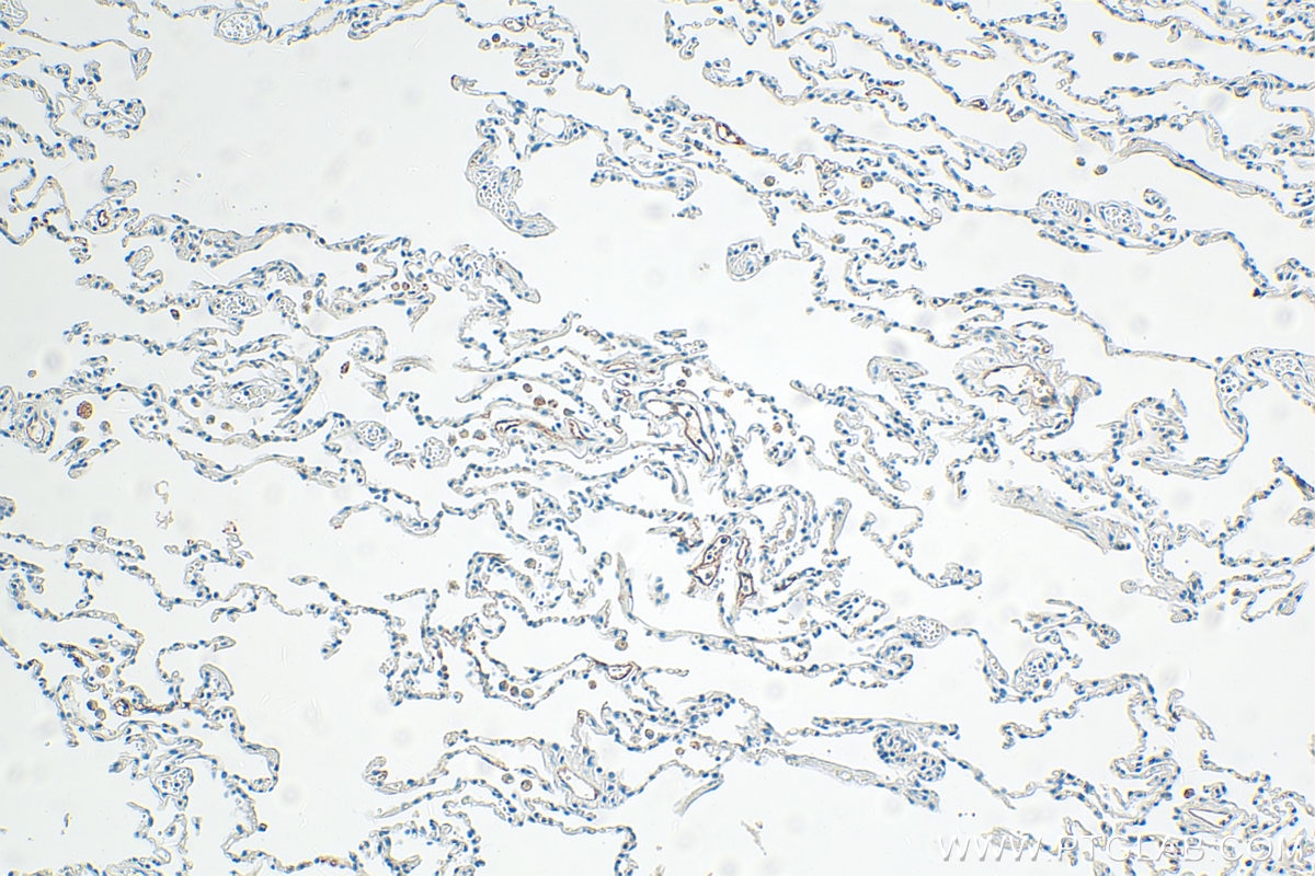Immunohistochemistry (IHC) staining of human lung tissue using LYVE1 Polyclonal antibody (32649-1-AP)