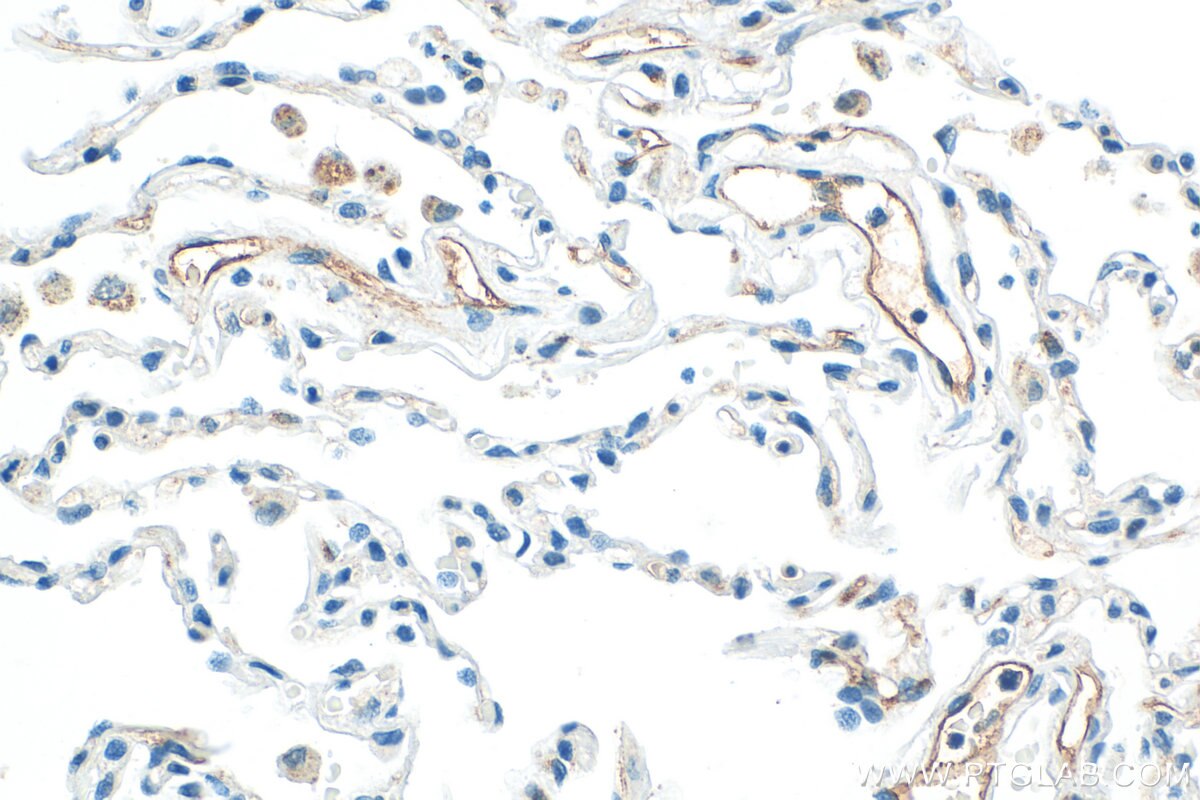 Immunohistochemistry (IHC) staining of human lung tissue using LYVE1 Polyclonal antibody (32649-1-AP)