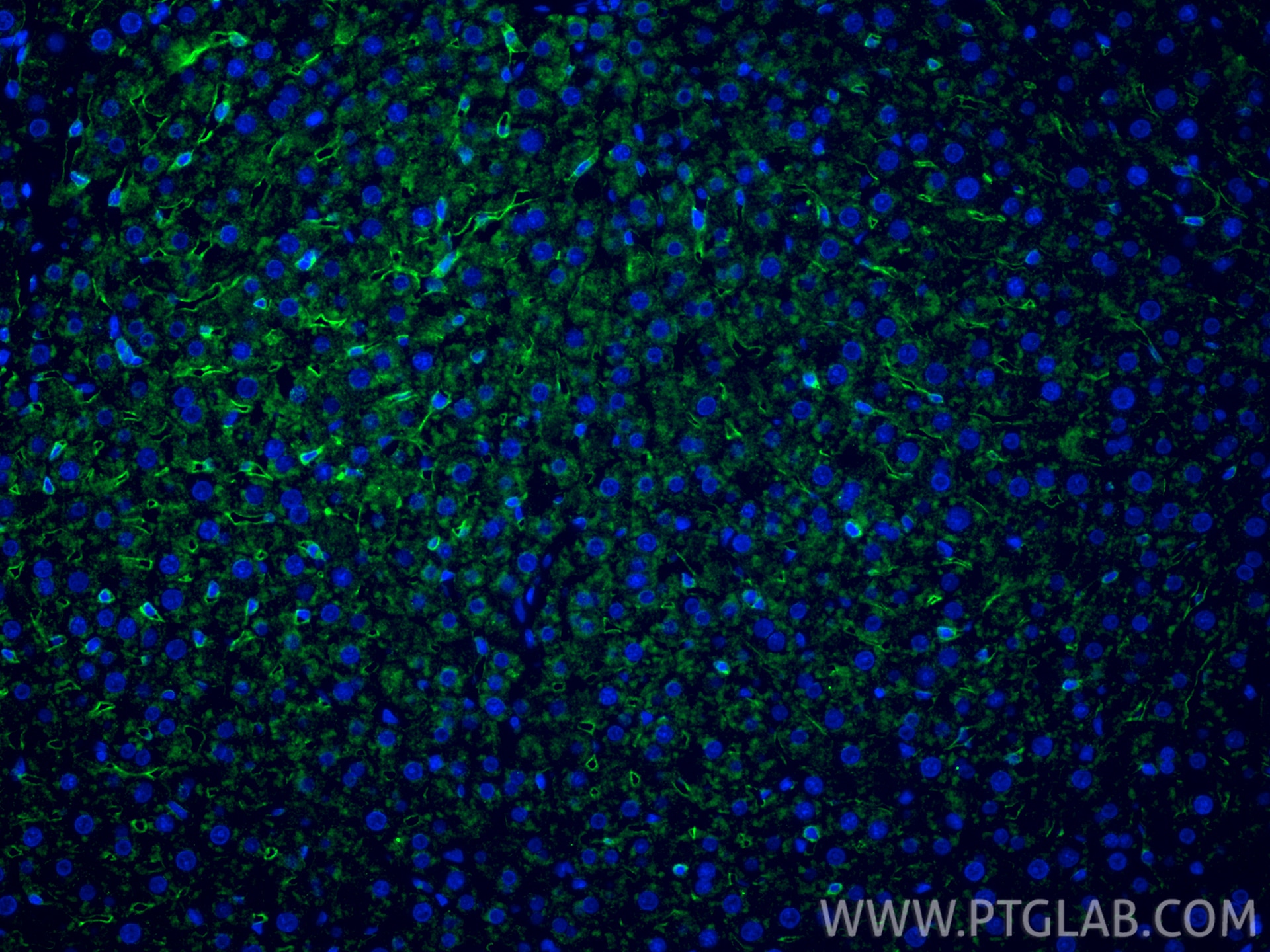 Immunofluorescent analysis of (4% PFA) fixed paraffin-embedded rat liver tissue using LYVE1 antibody (28321-1-AP) at dilution of 1:200 and CoraLite®488-Conjugated Goat Anti-Rabbit IgG(H+L) (SA00013-2). Heat mediated antigen retrieval with Tris-EDTA buffer (pH 9.0). Immunofluorescence (IF) / fluorescent staining of rat liver tissue using LYVE1 Polyclonal antibody (28321-1-AP)