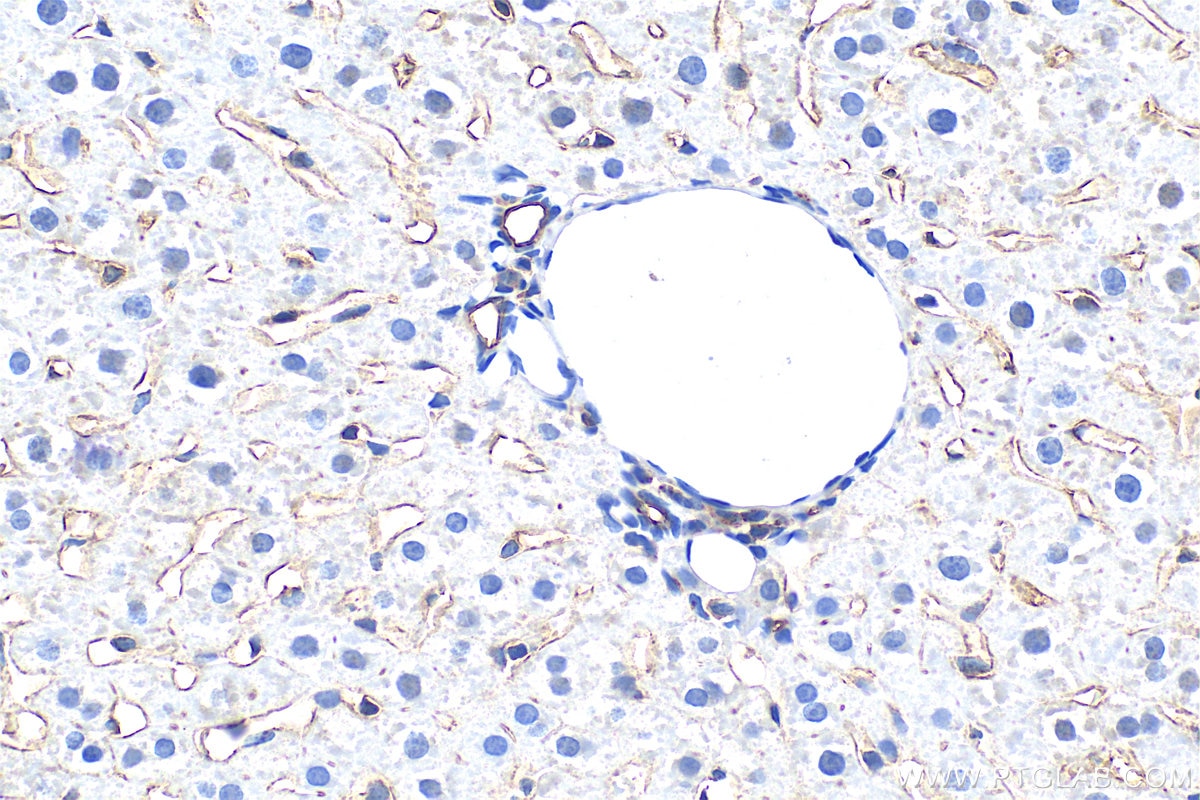 Immunohistochemical analysis of paraffin-embedded rat liver tissue slide using 28321-1-AP (LYVE1 antibody) at dilution of 1:800 (under 40x lens). Heat mediated antigen retrieval with Tris-EDTA buffer (pH 9.0). Immunohistochemistry (IHC) staining of rat liver tissue using LYVE1 Polyclonal antibody (28321-1-AP)
