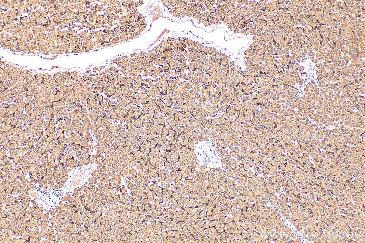 Immunohistochemistry (IHC) staining of human liver tissue using LYVE1 Polyclonal antibody (28321-1-AP)