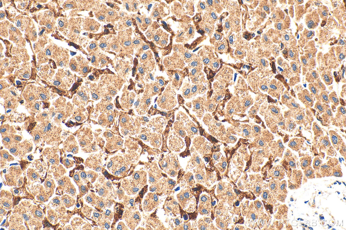 Immunohistochemistry (IHC) staining of human liver tissue using LYVE1 Polyclonal antibody (28321-1-AP)