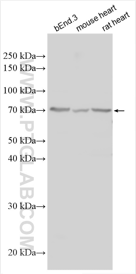 Western Blot (WB) analysis of various lysates using LYVE1 Polyclonal antibody (28321-1-AP)