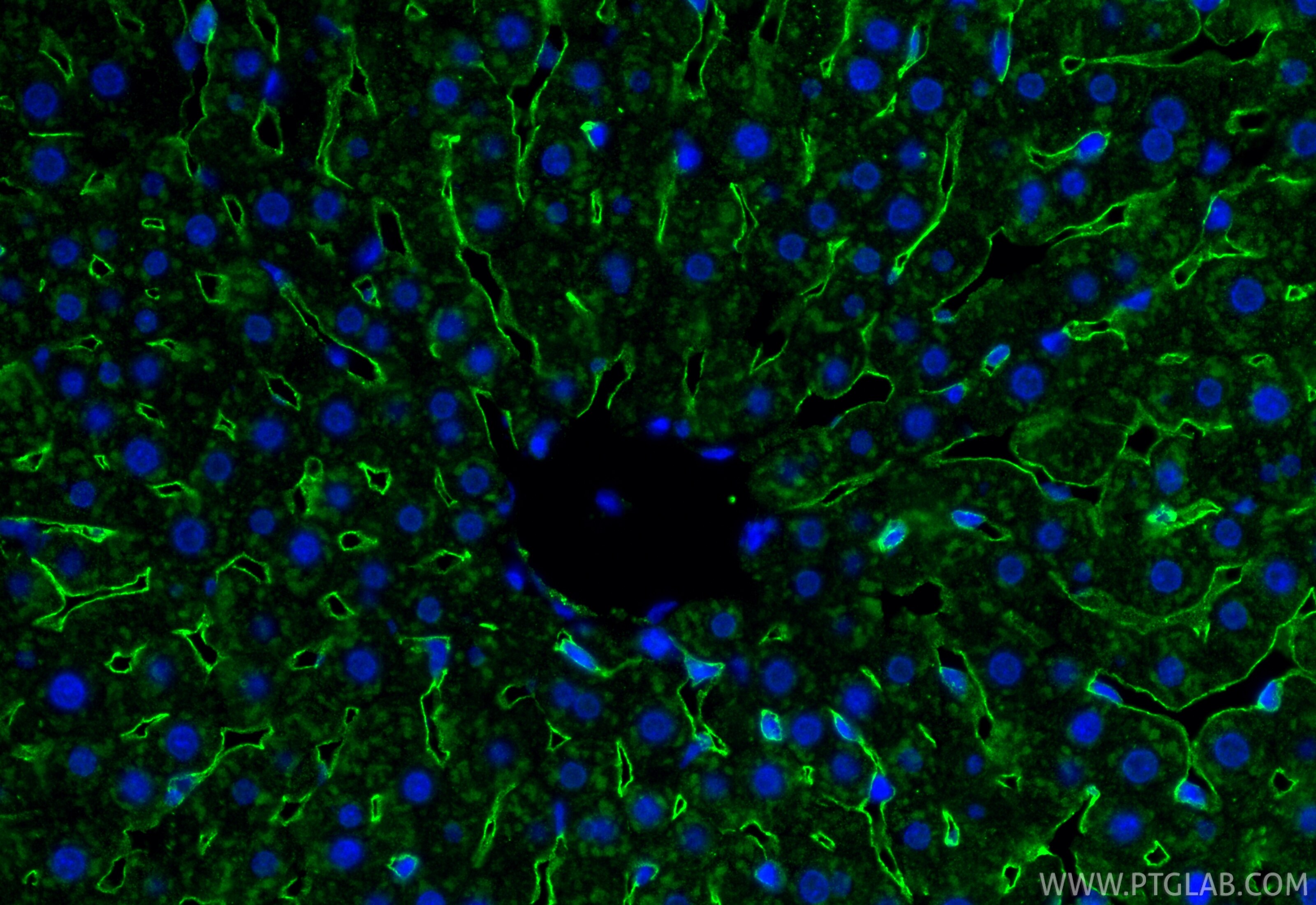 Immunofluorescence (IF) / fluorescent staining of rat liver tissue using LYVE1 Polyclonal antibody (34236-1-AP)