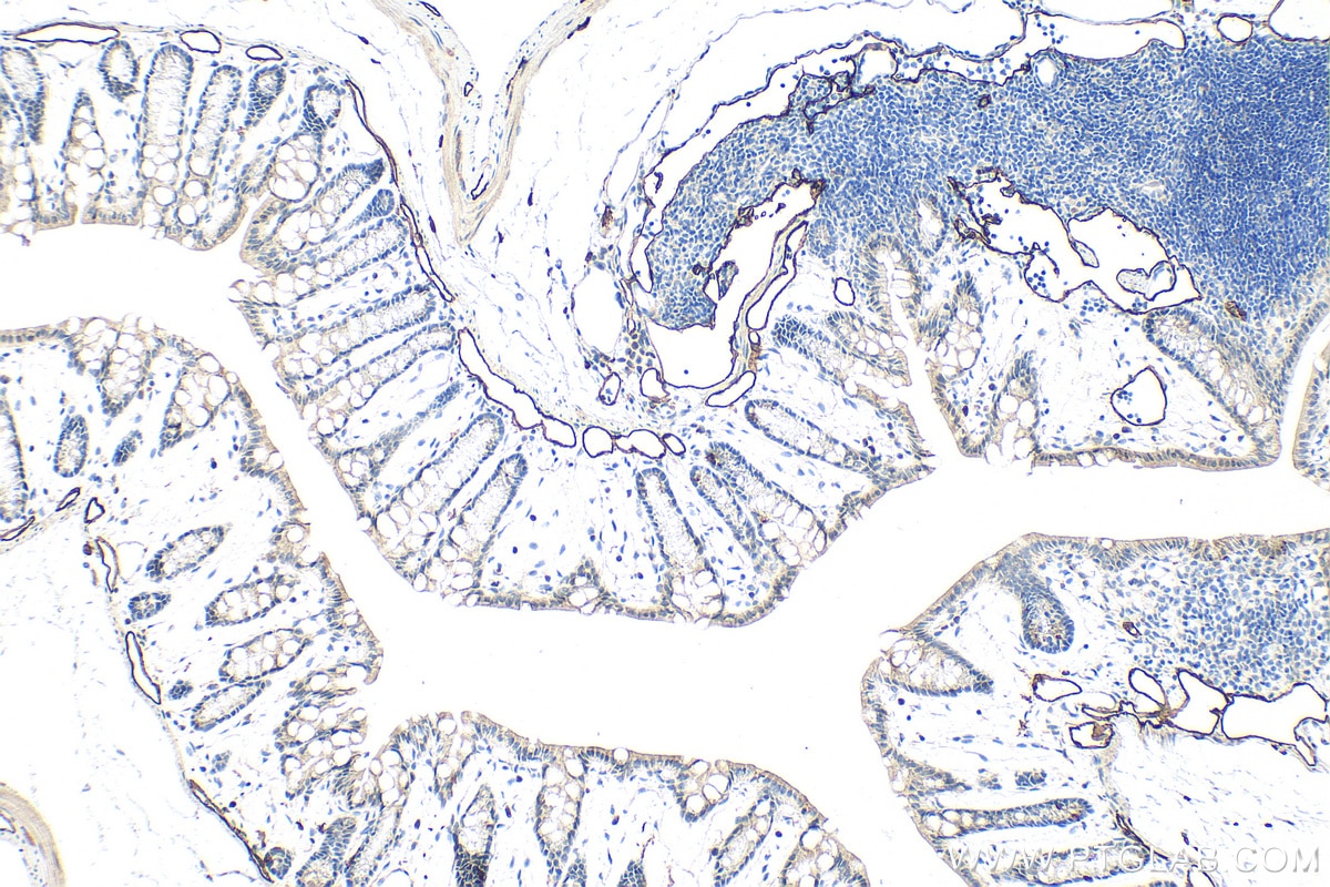 Immunohistochemistry (IHC) staining of mouse colon tissue using LYVE1 Polyclonal antibody (34236-1-AP)