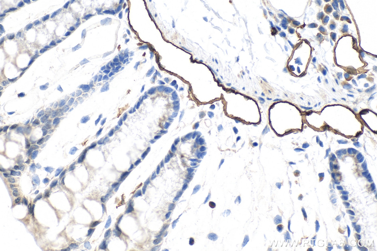 Immunohistochemistry (IHC) staining of mouse colon tissue using LYVE1 Polyclonal antibody (34236-1-AP)
