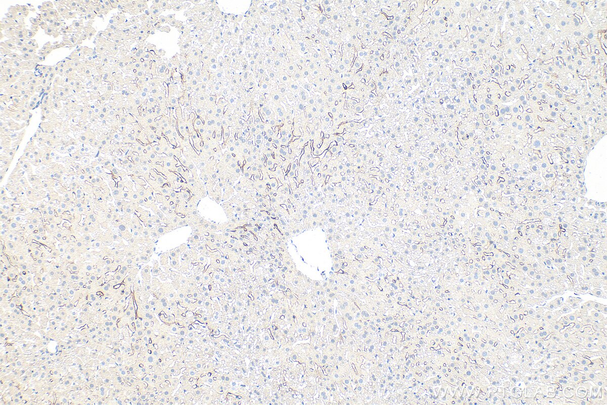 Immunohistochemistry (IHC) staining of mouse liver tissue using LYVE1 Polyclonal antibody (34236-1-AP)
