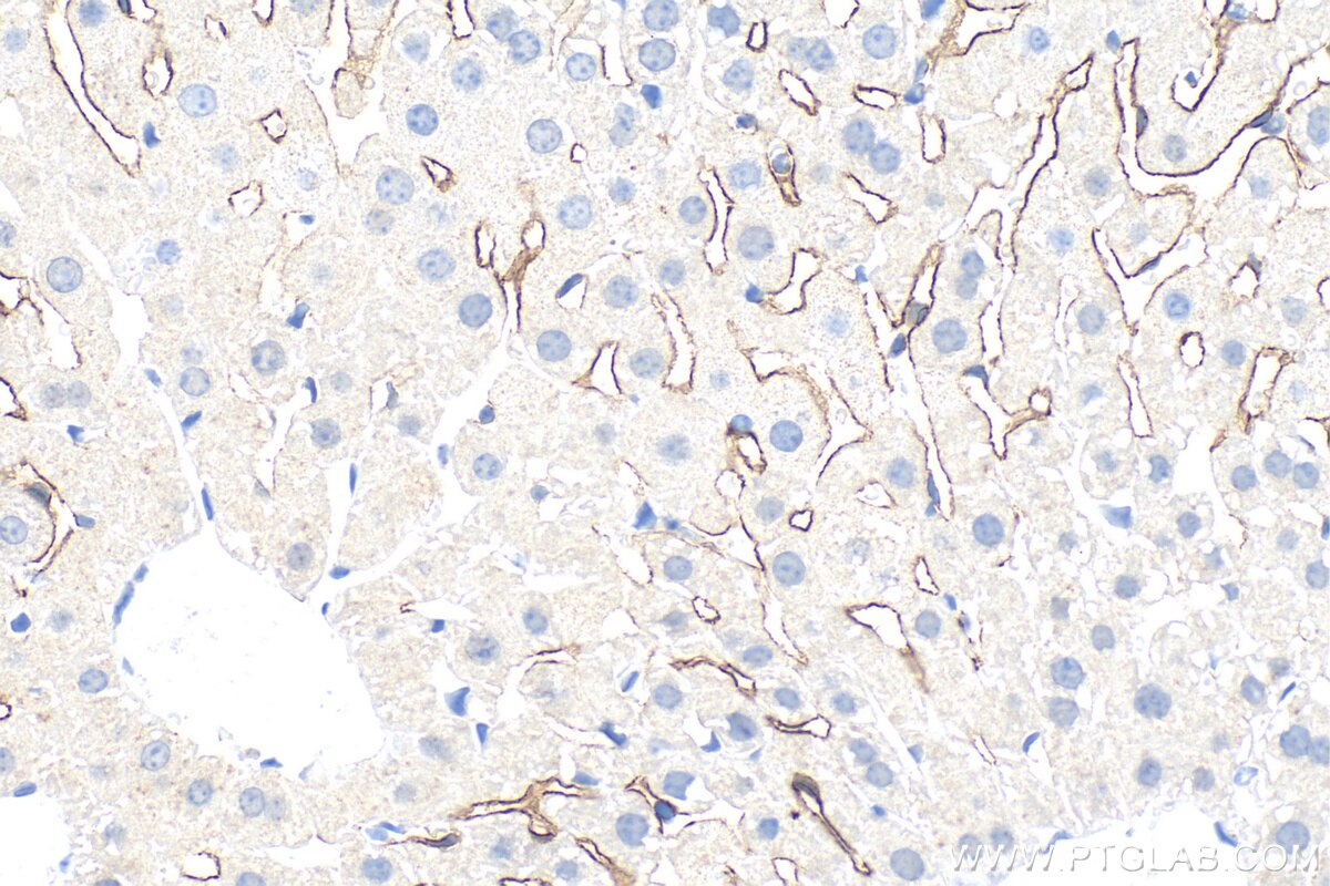 Immunohistochemistry (IHC) staining of mouse liver tissue using LYVE1 Polyclonal antibody (34236-1-AP)