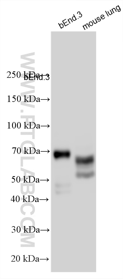 Western Blot (WB) analysis of various lysates using LYVE1 Polyclonal antibody (34236-1-AP)