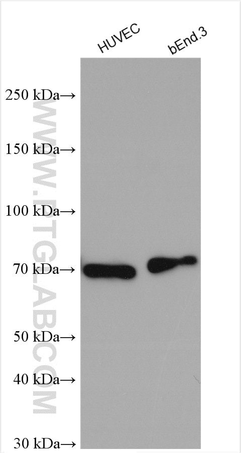 Western Blot (WB) analysis of various lysates using LYVE1 Polyclonal antibody (51011-1-AP)