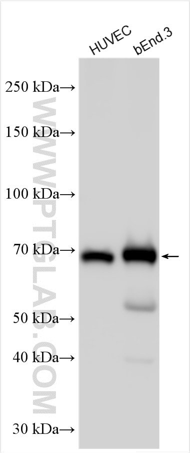 Western Blot (WB) analysis of various lysates using LYVE1 Polyclonal antibody (51011-1-AP)