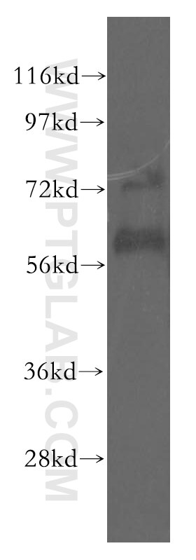 Western Blot (WB) analysis of human brain tissue using LYVE1 Polyclonal antibody (51011-1-AP)