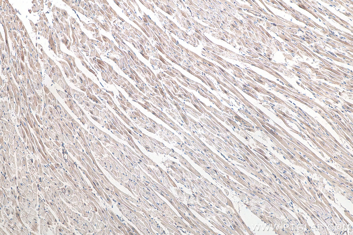 Immunohistochemistry (IHC) staining of mouse heart tissue using Lysozyme Polyclonal antibody (15013-1-AP)