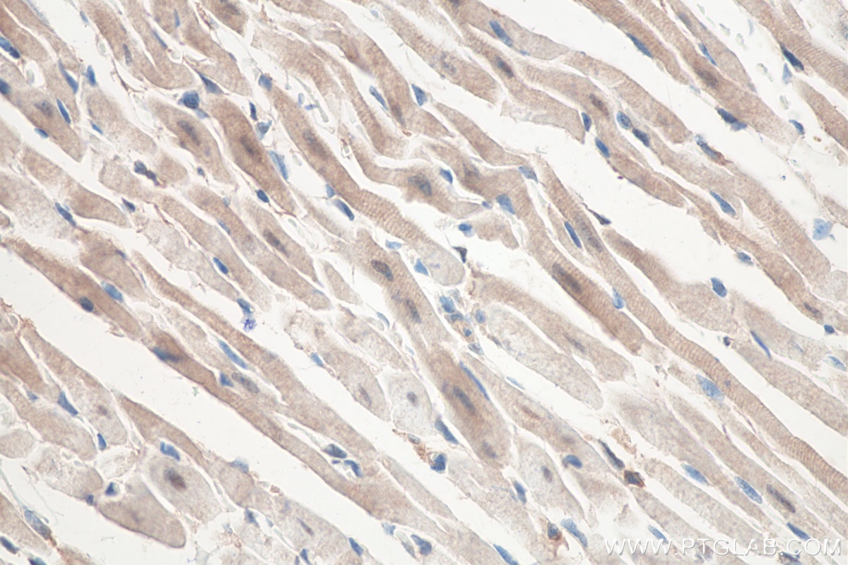 Immunohistochemistry (IHC) staining of mouse heart tissue using Lysozyme Polyclonal antibody (15013-1-AP)